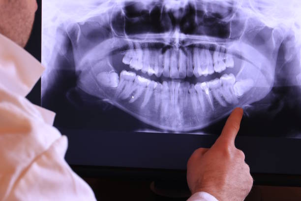Best Pediatric Emergency Dentist in Parkwood, WA