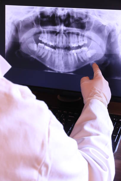 Best Emergency Dentist for Lost Fillings or Crowns in Parkwood, WA